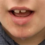 تعبیر خواب آب دهان انداختن برای زن متاهل و باردار و دختر مجرد از روانشناسی