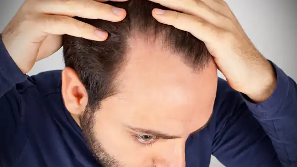 تعبیر خواب کم مویی برای زن متاهل و باردار و دختر مجرد از روانشناسی