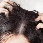 تعبیر خواب ساس در موی سر برای زن متاهل و باردار و دختر مجرد از روانشناسی