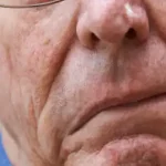 تعبیر خواب دیدن سکته مغزی برای زن متاهل و باردار و دختر مجرد از روانشناسی