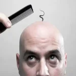 تعبیر خواب طاس شدن مرد برای زن متاهل و باردار و دختر مجرد از روانشناسی