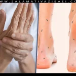 علل سوزن سوزن شدن دست و پا