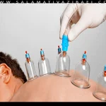 حجامت درمانی چیست؟