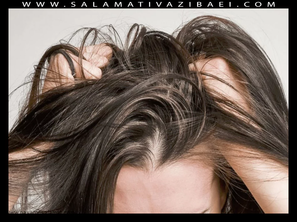 شایع ترین مشکلات پوست سر