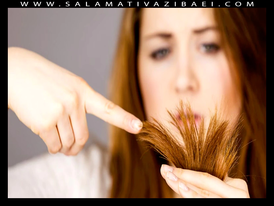 علل انشعاب انتهایی مو