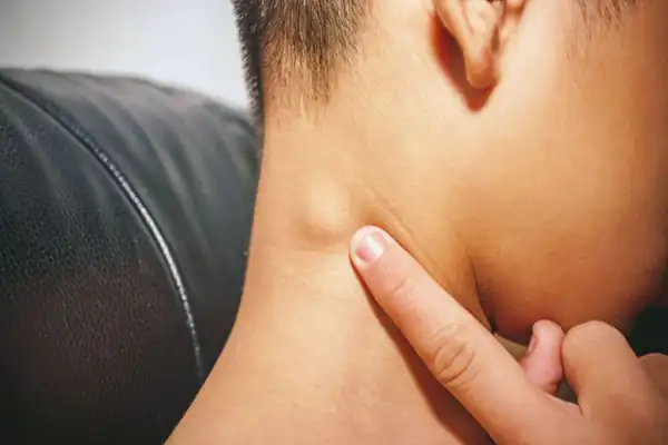 تعبیر خواب غده برای زن متاهل و باردار و دختر مجرد از روانشناسی