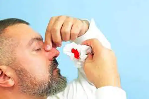 تعبیر خواب خون دماغ شدن شوهر برای زن متاهل و باردار و دختر مجرد از روانشناسی