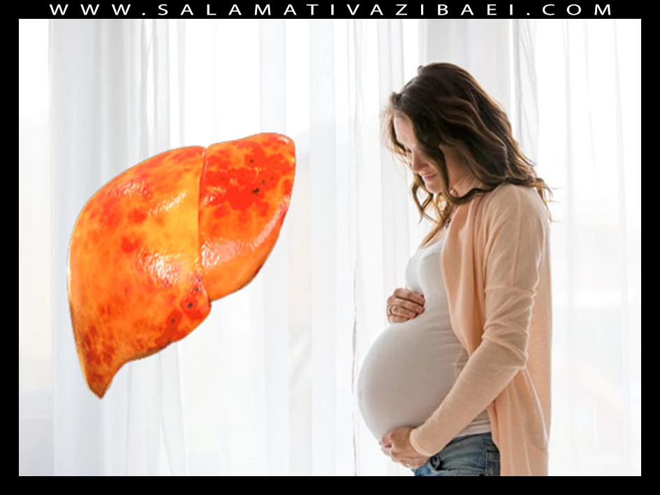 علل کبد چرب در بارداری