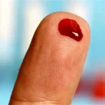 تعبیر خواب لخته خون از بدن برای زن متاهل و باردار و دختر مجرد از روانشناسی
