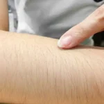 تعبیر خواب موی دست زن برای زن متاهل و باردار و دختر مجرد از روانشناسی