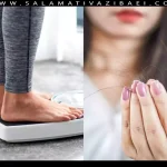 علل ارتباط ریزش مو و افزایش وزن در زنان