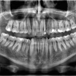 چرا دندانها استخوان محسوب نمیشوند؟