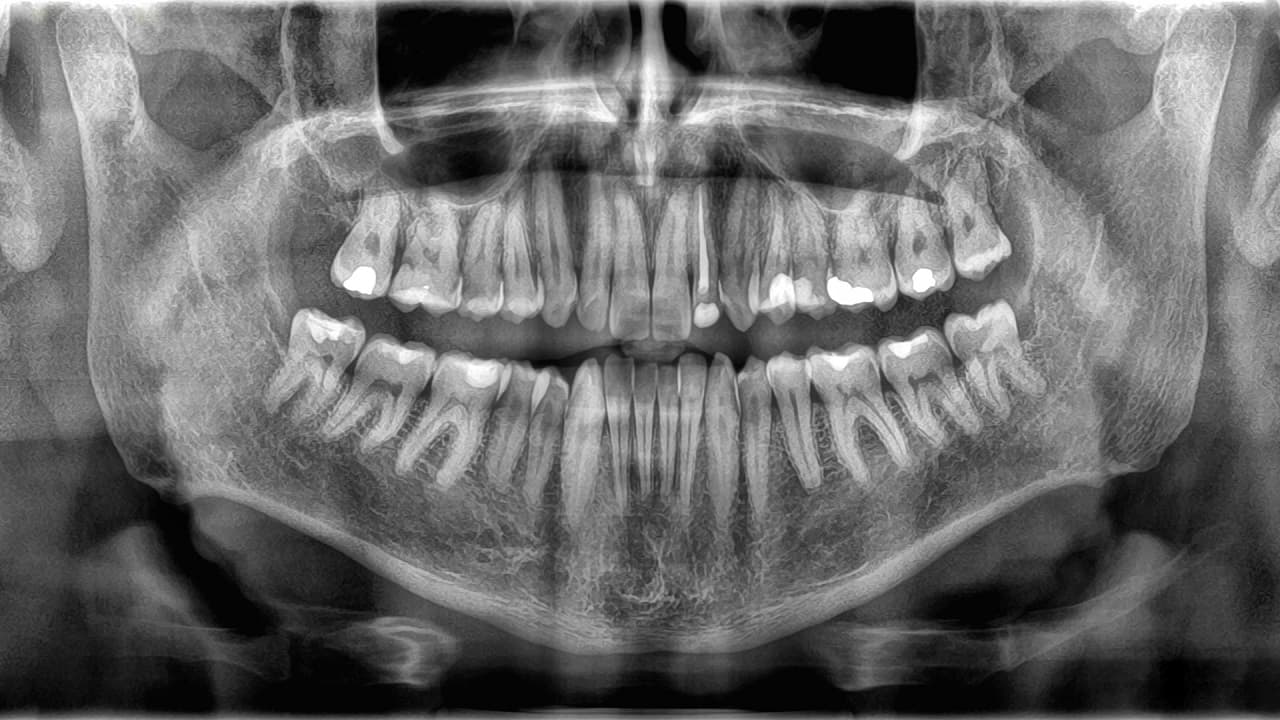 چرا دندان‌ها استخوان محسوب نمی‌شوند؟