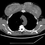 مورد عجیب مردی که عضلاتش به‌طرز غیرعادی تغییر کرده بود
