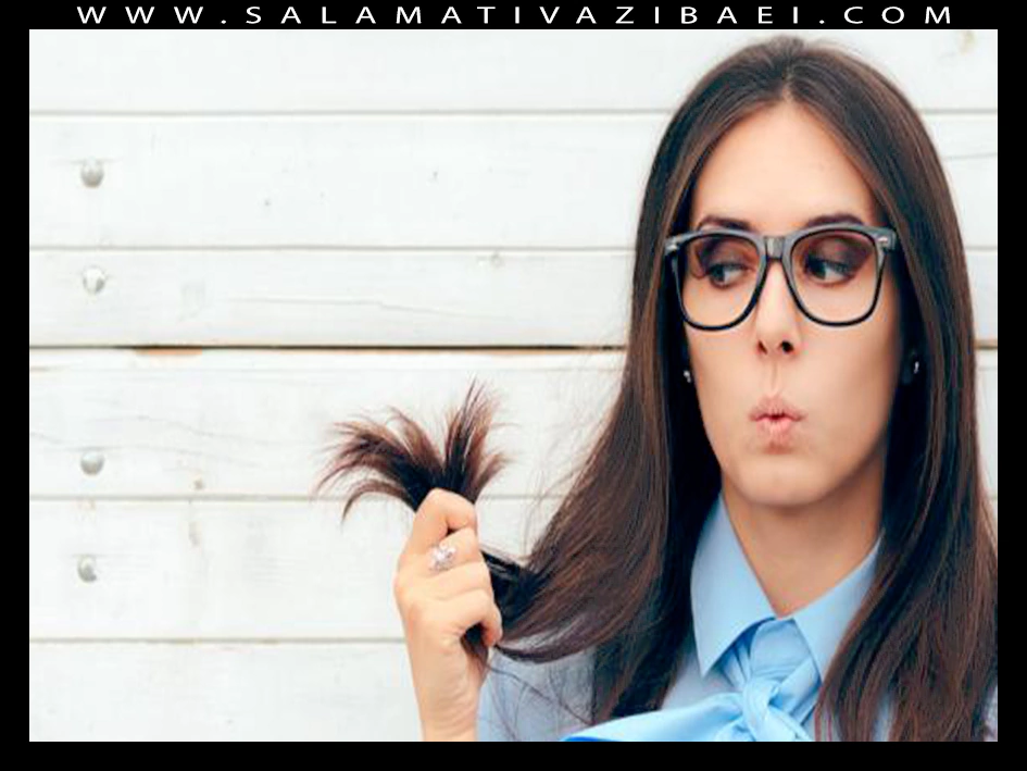 مشکلات رایج مو