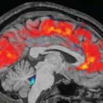 راز از کار افتادن مغز بر اثر بی‌خوابی طولانی‌مدت کشف شد
