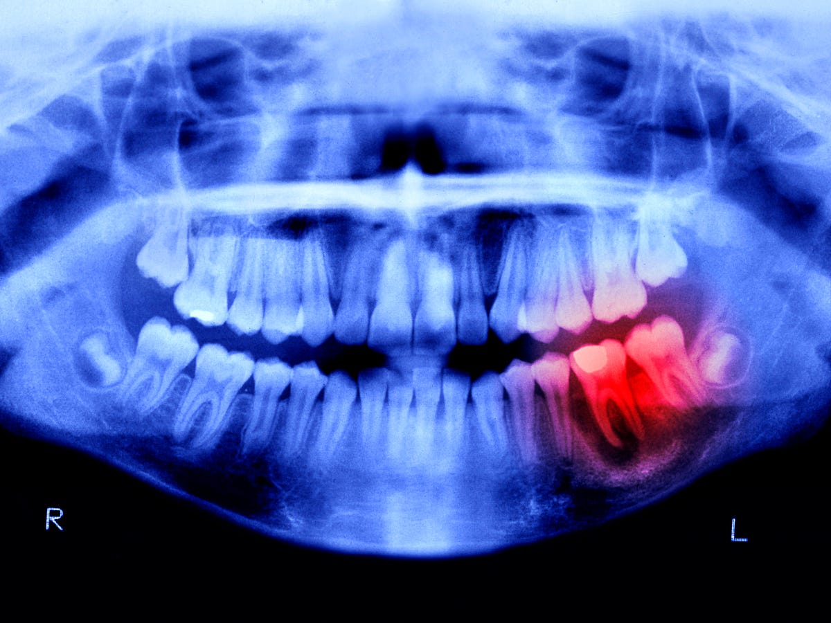 انسان‌ها تا ۴ سال آینده می‌توانند دندان‌های جدید رشد دهند