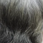 موی انسان خاکستری میشود تا از خطری بزرگ در امان بماند