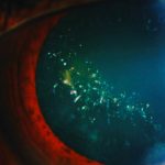 بیماری نادری که چشم‌ها را مانند درخت کریسمس درخشان می‌کند